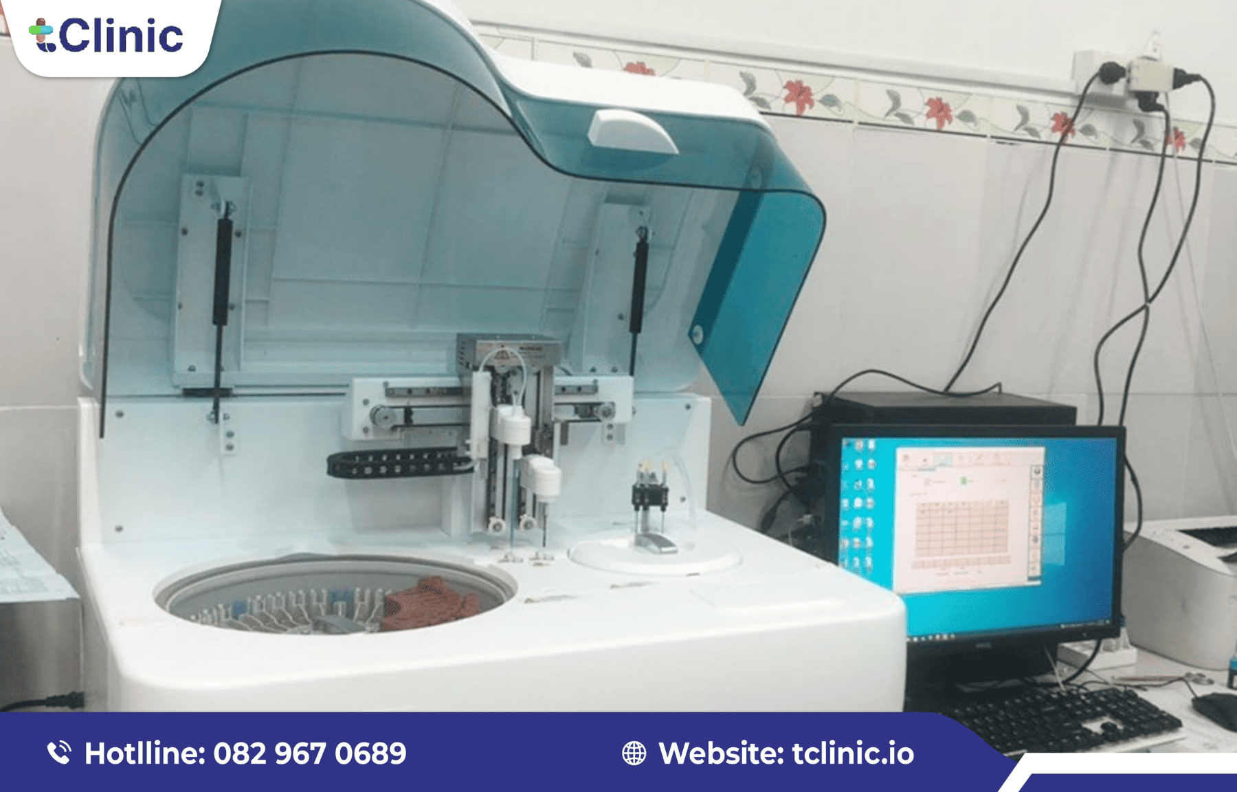 Cách tích hợp phần mềm với thiết bị siêu âm, xét nghiệm hiệu quả 5 Hệ thống thiết bị xét nghiệm tự động được kết nối với phần mềm.