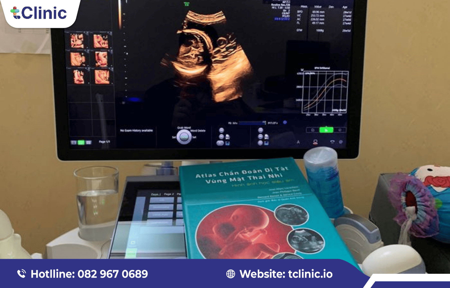 Trang thiết bị và tài liệu chuyên môn hỗ trợ chẩn đoán hình ảnh sản phụ khoa.